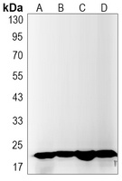 Anti-IL-26 Antibody