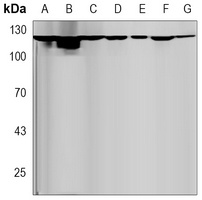 Anti-DGK zeta Antibody