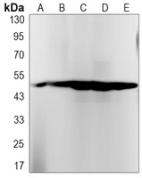 Cytochrome P450 2D6 antibody