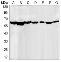 CCT2 antibody