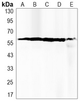 Anti-PPP3CA Antibody