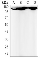 Anti-BCR Antibody