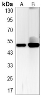 Anti-p53 (Phospho-S6) Antibody