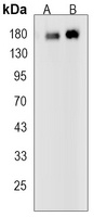 EGFR (phospho-Y1173) antibody