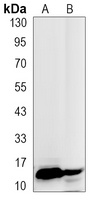 Histone H3 (TriMethyl-K27) antibody