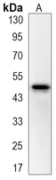 Wnt-5a antibody