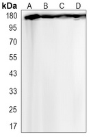 Anti-VEGFR1 Antibody
