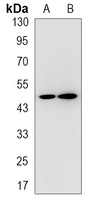 Anti-RNF81 Antibody