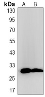 Anti-TMEM192 Antibody