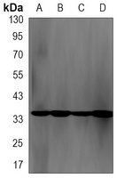 Anti-NEK7 Antibody