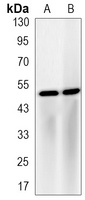 LXR alpha antibody