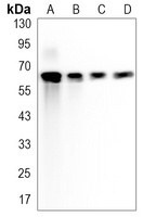 Anti-LTA4H Antibody