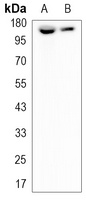 CD49e HC antibody