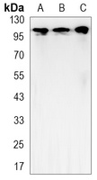 Anti-Hexokinase 2 Antibody