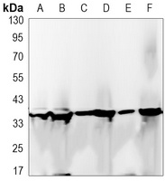 Anti-GAPDH Antibody