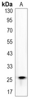 Anti-Galectin 3 Antibody