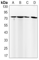 FUBP1 antibody