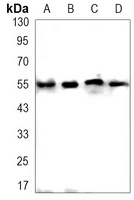 Anti-DFNA5 Antibody