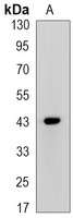 Anti-CREB (Phospho-S133) Antibody