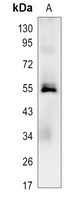 Anti-Caspase 8 Antibody