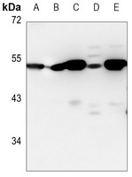 Anti-ADSS Antibody