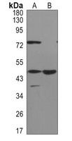Anti-ACOX1 Antibody