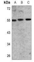 AKT (phospho-S473) antibody