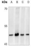 Anti-GSK3 beta (Phospho-S9) Antibody