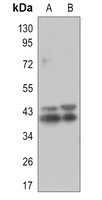 Anti-ERK1/2 (Phospho-T202/T185) Antibody