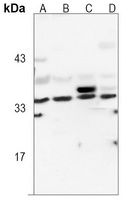 Anti-LDHA Antibody