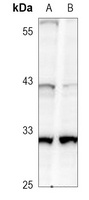 Anti-Caspase 3 Antibody