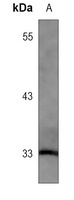 Anti-HO-1 Antibody