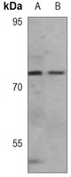 Anti-PKR Antibody