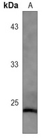 Anti-Caveolin 1 Antibody