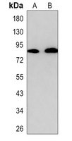 Anti-CD91 Antibody