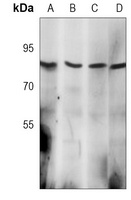 Anti-MLH1 Antibody