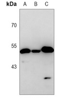 Anti-PGD Antibody