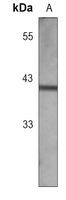 Anti-AT1 Antibody