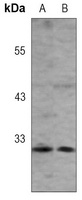 Anti-CD273 Antibody