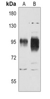 Anti-CD54 Antibody