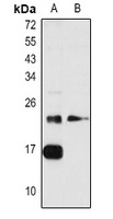 Anti-RhoA Antibody