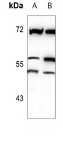 Anti-MATK Antibody