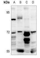 Anti-CD126 Antibody