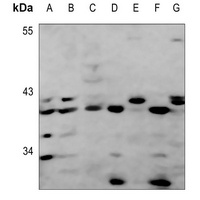 Anti-GPR92 Antibody