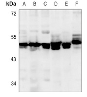 Anti-GPR152 Antibody