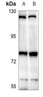 Anti-THOC5 Antibody