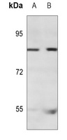 Anti-NEK4 Antibody