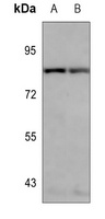 ARHGAP11A antibody