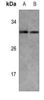 Anti-KDELR3 Antibody