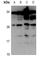 Anti-ZNRF1 Antibody